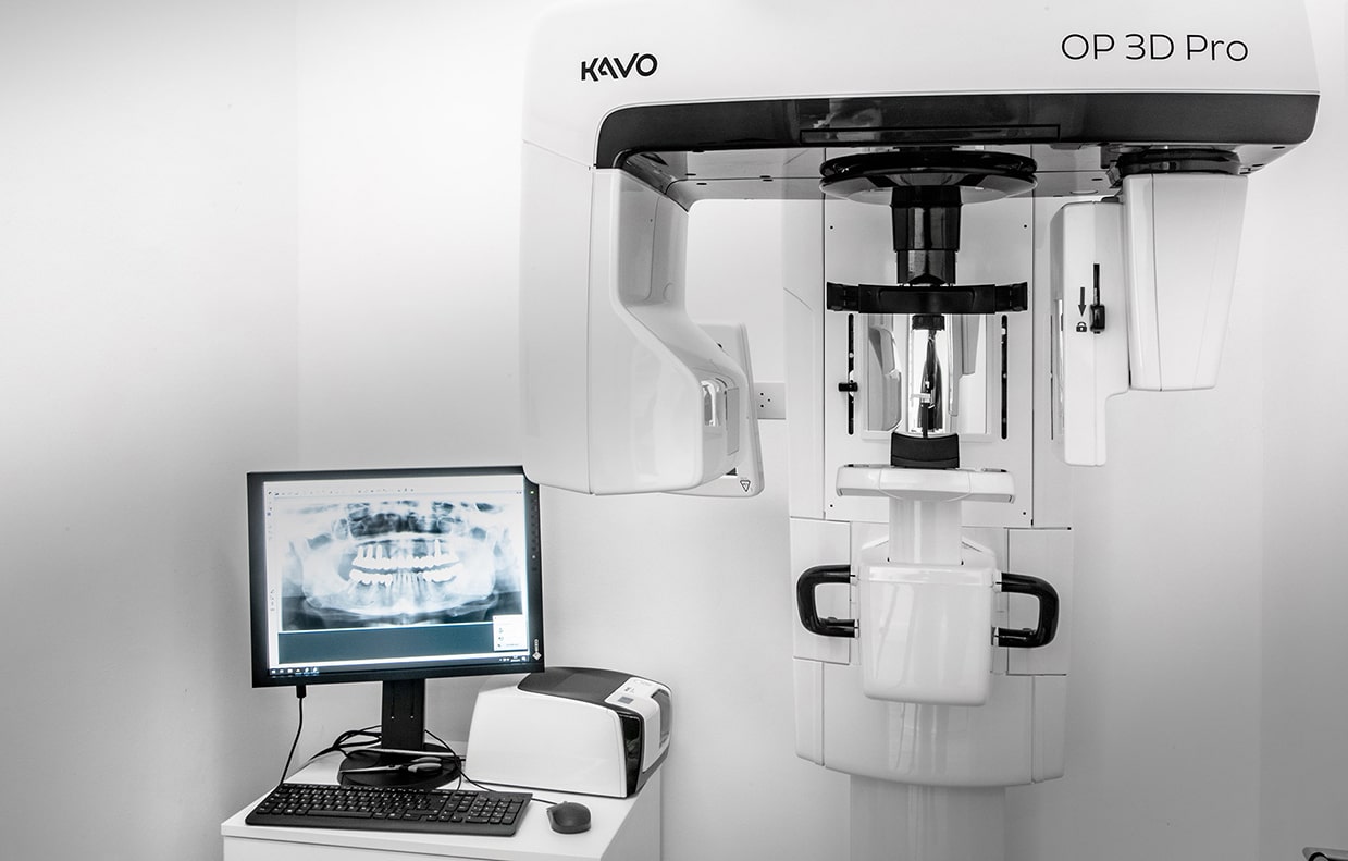 Zahnarztpraxis Memisi Aachen – Diagnostik